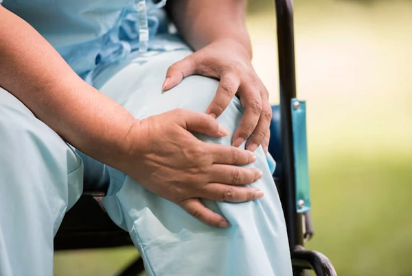 Arthritis Management