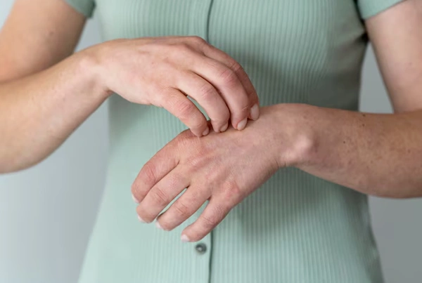 Lupus Related Pain