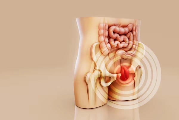 Hernias and Surgical Complications