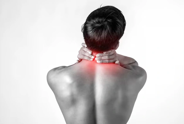 Cervical Radiculopathy