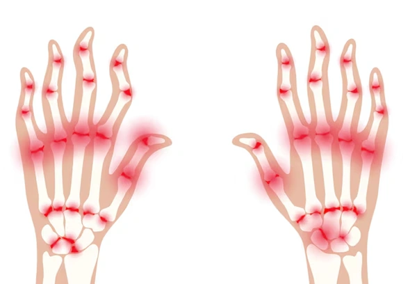 Other Chronic Pain Conditions